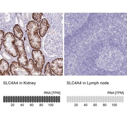 SLC4A4 Antibody, Novus Biologicals 0.1 mL | Buy Online | Novus Biologicals | Fisher Scientific